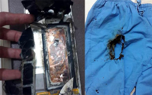 Hasta muayene ederken cebindeki telefon patladı! - Resim: 2