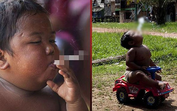 2 yaşında dünyayı şoke etmişti yeni hali çok başka - Resim: 2