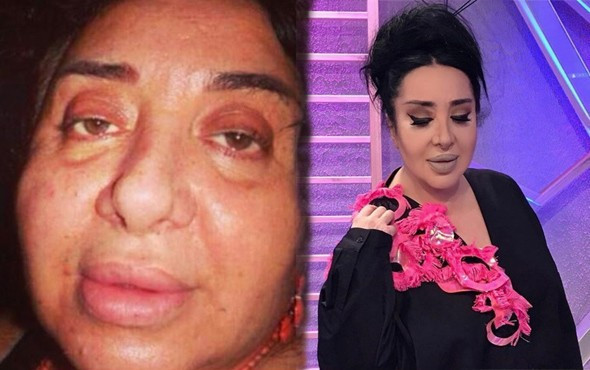 Nur Yerlitaş'ın sağlık durumu son durum - Resim: 1