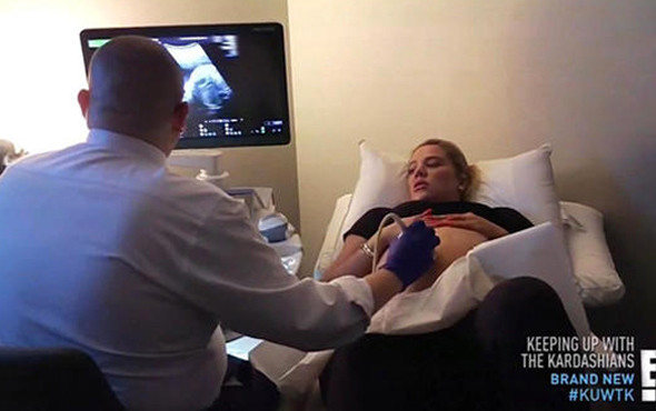 Kameralar karşısında doğum yaptı! - Resim: 4