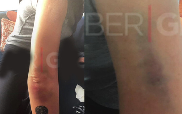 Korkunç detaylar: Sıla'nın darp raporu ortaya çıktı! - Resim: 2