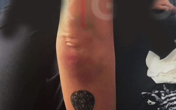 Korkunç detaylar: Sıla'nın darp raporu ortaya çıktı! - Resim: 3