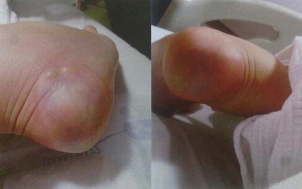 'Topuk yakma' davasında karar! 2 hemşirenin cezası... - Resim: 2