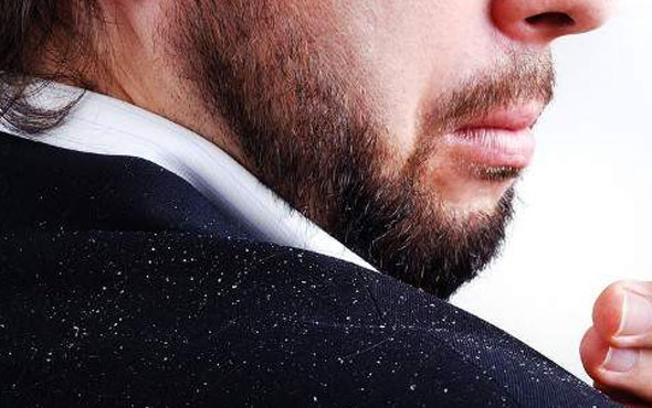 Saçınızdaki kepeklerden kurtulmanın sırları - Resim: 1