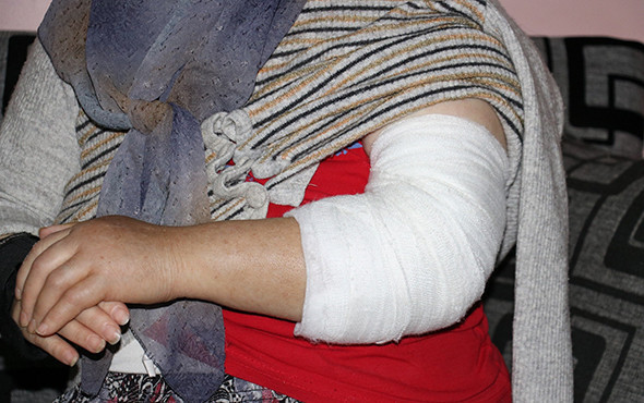 Şaka gibi olay! Otomobil çarpınca sakat kaldı ama... - Resim: 3