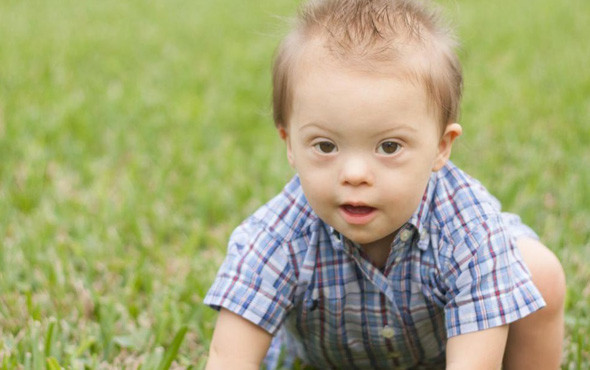 Down Sendromu nedir? 7 soruda bilmeniz gerekenler - Resim: 1