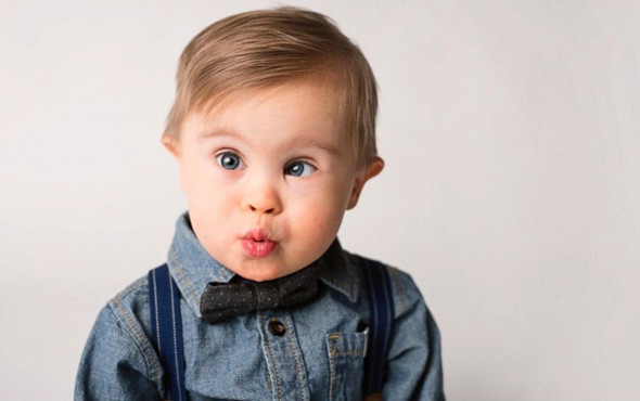 Down Sendromu nedir? 7 soruda bilmeniz gerekenler - Resim: 2