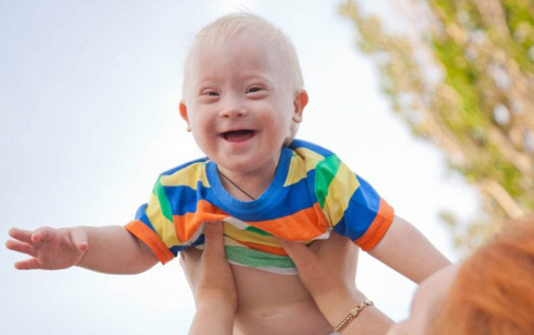 Down Sendromu nedir? 7 soruda bilmeniz gerekenler - Resim: 3