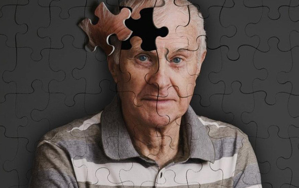 Alzheimer nedir belirtileri nelerdir ? İşte dikkat etmeniz gerekenler.. - Resim: 1