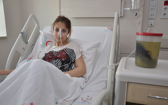 Karın ağrısıyla gitti: Hasta da doktor da gözlerine inanamadı! - Resim: 2