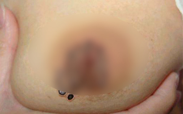 İç çamaşırı satın alıp giydi göğsü böcek yuvasına dönüştü inanılmaz kare! - Resim: 4