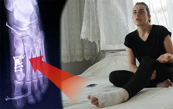 Sağlam parmağa ameliyatta ikinci perde! - Resim: 1