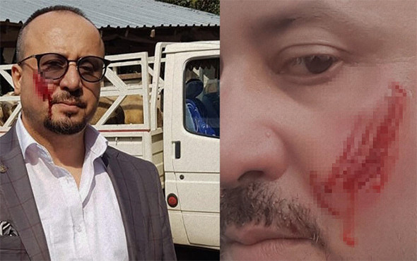 Avukat hayatının şokunu yaşadı: Yanağını kopardı! - Resim: 1