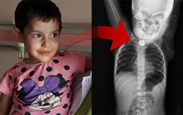 1,5 yaşındaki Berfin bebek herkesi korkuttu! - Resim: 1