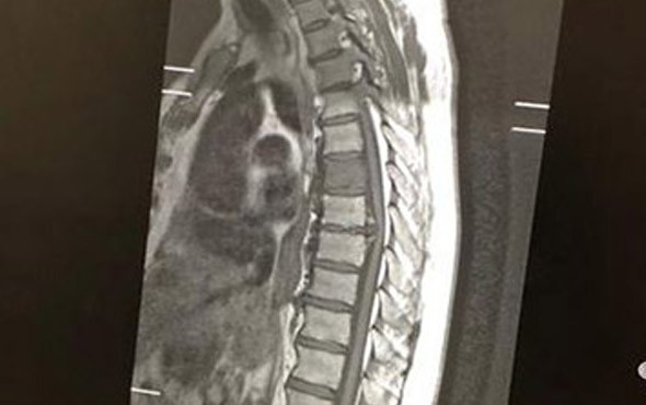 70 yaşındaki adamın içinden köpek çıktı! - Resim: 4