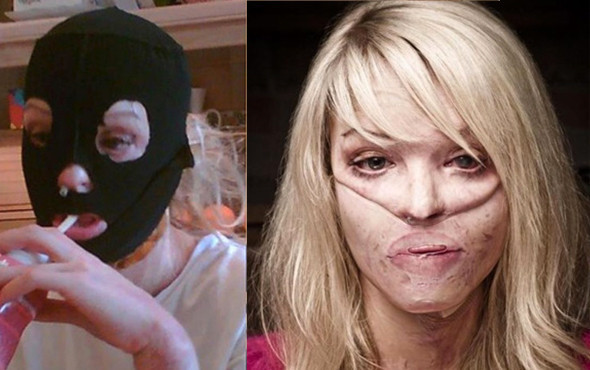 Eski sevgilisi tecavüz edip yüzüne asit fırlattı! Kadın bambaşka biri oldu - Resim: 1