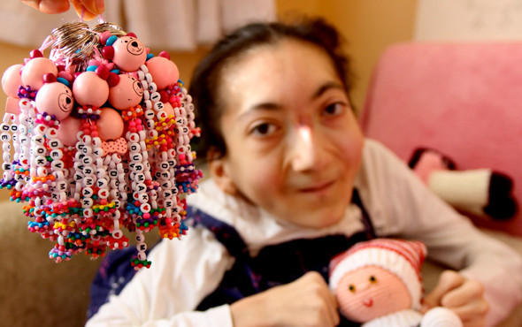 Yüzde 95 engeli var ama yaptıkları inanılmaz çocukluk hayali gerçek oluyor - Resim: 4