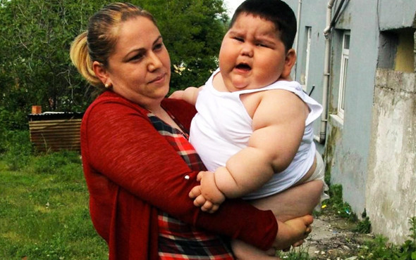 Yağız bebeğe ilaç yaramadı 18 kilo daha aldı son hali ailesini korkuttu - Resim: 4