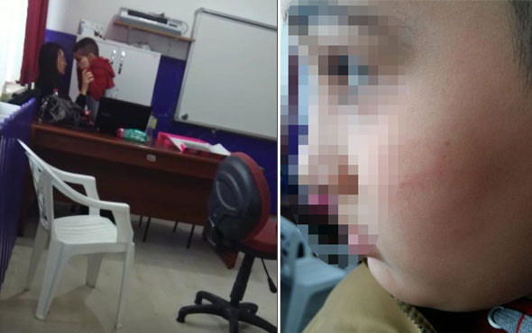 Cani öğretmen! Otizmli çocuğu dövüp morlukları da böyle kapatmış - Resim: 1