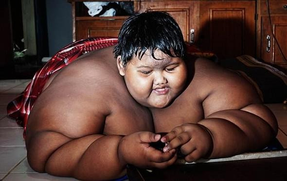 Dünyanın en şişman çocuğuydu! Son hali bomba - Resim: 4