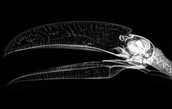 Sağlık kontrolleri için X-Ray'e girdiler - Resim: 3
