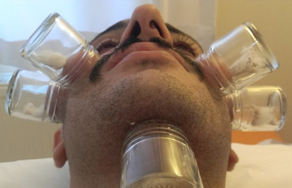 Hacamat hangi günler yapılır faydaları! Hacamat öncesi cinsel ilişki... - Resim: 3