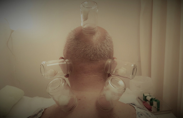 Hacamat hangi günler yapılır faydaları! Hacamat öncesi cinsel ilişki... - Resim: 4