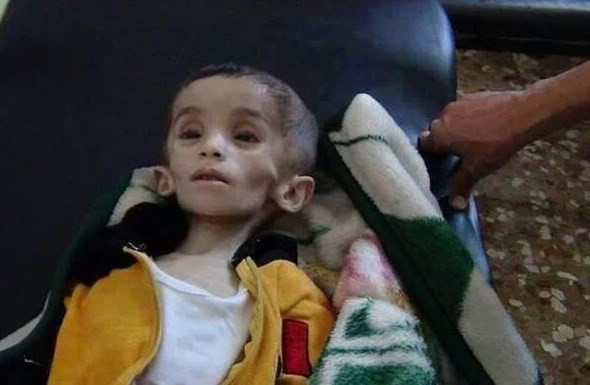 Açlıktan kırılan Medaya'ya yardım gitti - Resim: 3