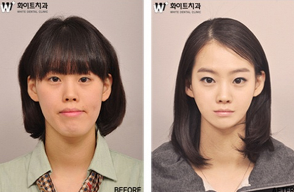 Estetikle öyle değiştiler ki! - Resim: 3