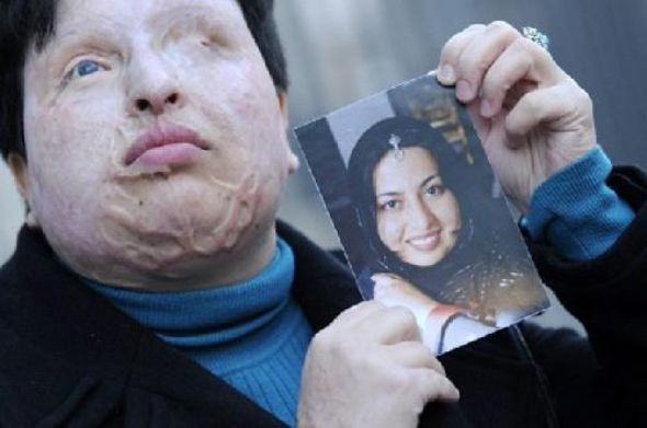 Kezzaplı intikamdan vazgeçti - Resim: 4