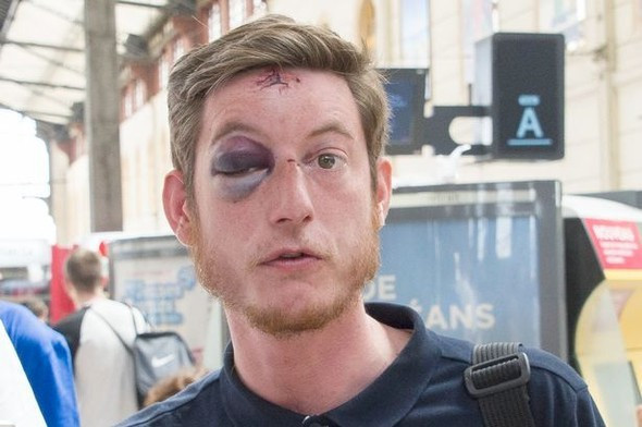 İngiliz taraftar bu hale geldi - Resim: 1