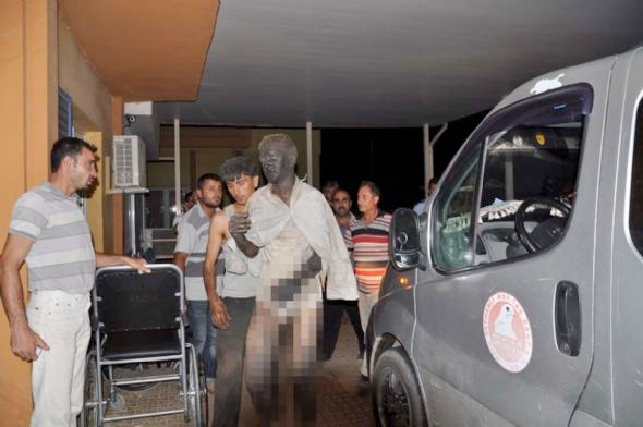 Suriye'den gelenlerin hali dehşet verici - Resim: 1