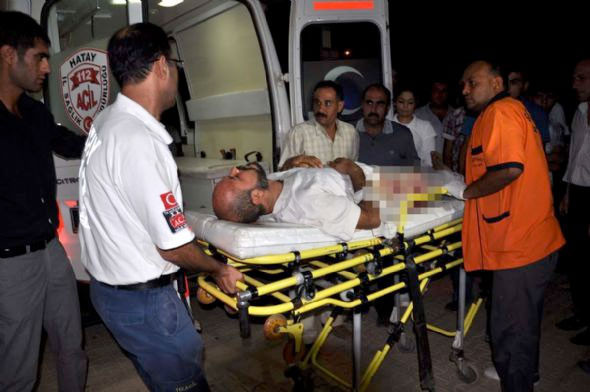 Suriye'den gelenlerin hali dehşet verici - Resim: 2