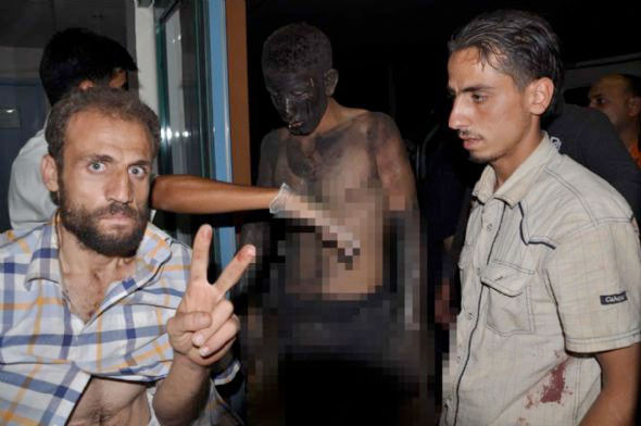 Suriye'den gelenlerin hali dehşet verici - Resim: 4