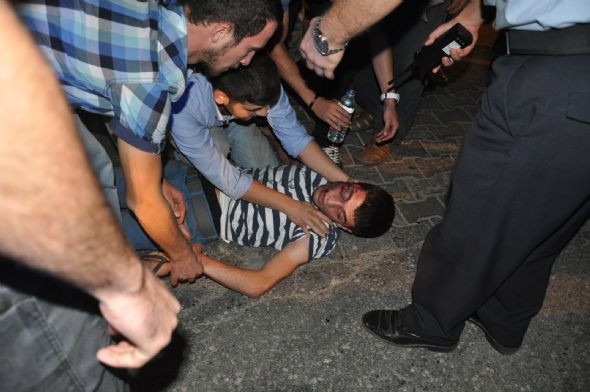 Yardım beklerken üstünden otomobil geçti - Resim: 3