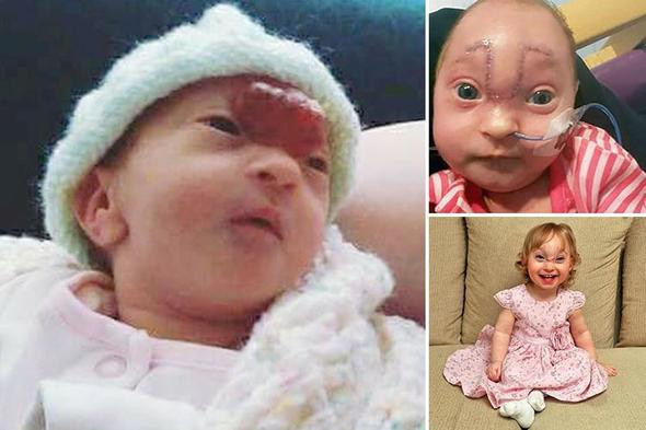 Tüm dünya onu konuştu beyni dışarıda doğdu! - Resim: 3