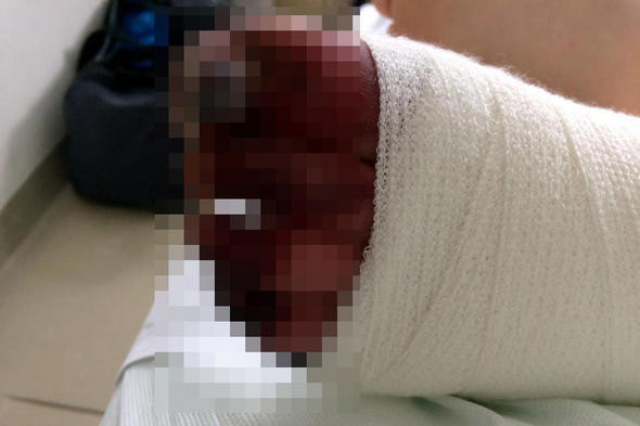 Kızarmış tavuk yedi yanlış teşhis hayatını kararttı! - Resim: 3