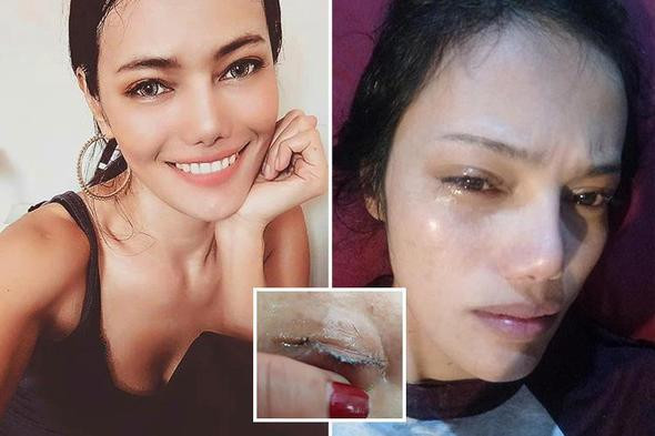 Güzellik uğruna kirpiklerinden oldu - Resim: 1