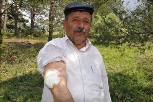 15 yıl kolundaki bezle yaşadı - Resim: 1