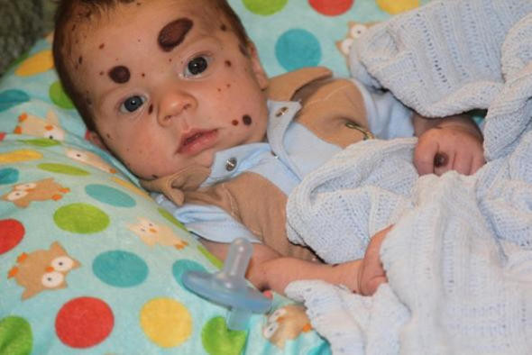 Bu şekilde doğdu! Doktor gerçeği açıkladı herkes şaşırdı - Resim: 2