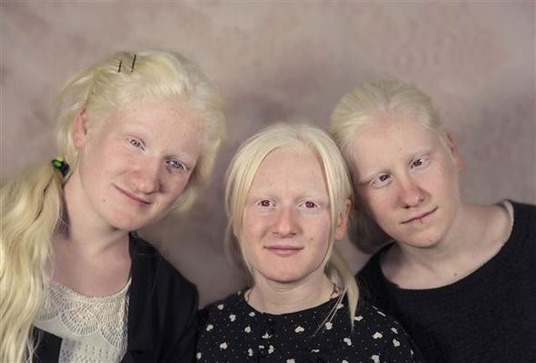 Onlar Türkiye'nin beyaz melekleri gören bir acayip bakıyor - Resim: 3