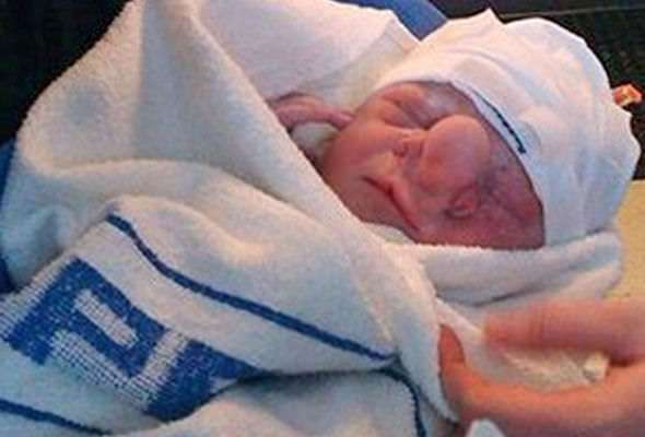 Bebeği bu halde dünyaya geldi görenler gözlerine inanamadı 3 yıl sonra... - Resim: 3