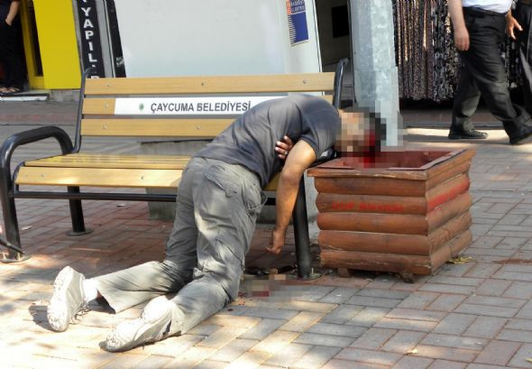 Bu görüntü kan dondurdu (+18) - Resim: 1