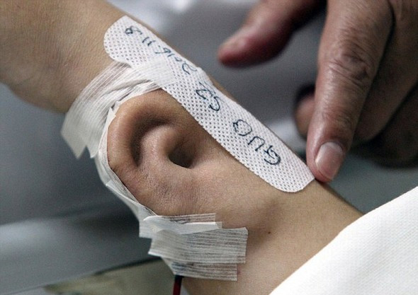 Kulağı tamamen parçalanmıştı mucize estetik - Resim: 2