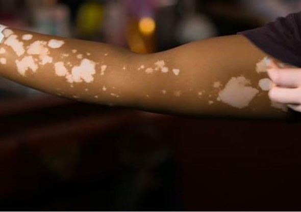 Ailesinden bile saklamış! Makyajını silmeye başladı ve... - Resim: 3