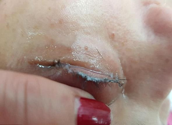 Güzellik uğruna kirpiklerinden oldu - Resim: 2