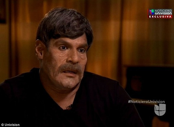 Erkek sevgilisi ortaya çıktı saldırının nedenini açıkladı! - Resim: 1