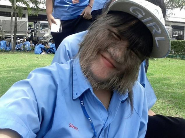 'Kurt kız' büyüdü son haline bakın - Resim: 3