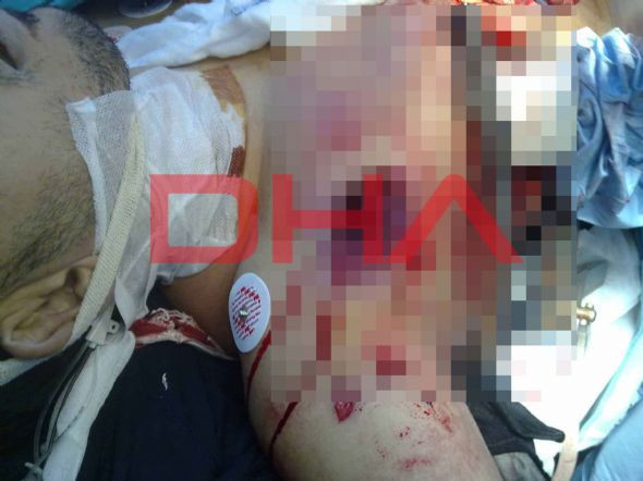 Libya'dan dehşet verici kareler! - Resim: 2