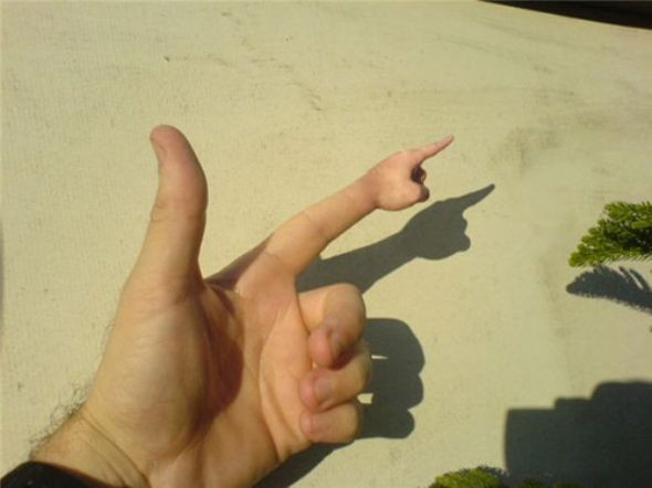 Bunlara bakmak yürek ister! - Resim: 4